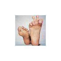 2 Zehe, die Frieden zeigen.jpg